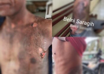 Lagi Minum Tuak , Pemilik warung Siram Tiga Pria Dengan Air Panas di Silou Kahean