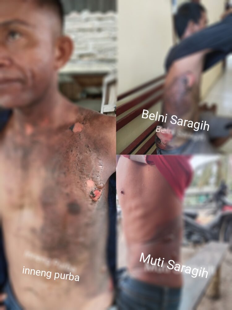 Lagi Minum Tuak , Pemilik warung Siram Tiga Pria Dengan Air Panas di Silou Kahean