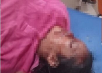 Warga Tengkoh Diduga Korban Begal, Sepeda Motor Dirampas