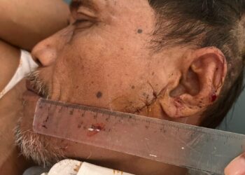 Aca Warga Bukit Lawang Dianiaya Terduga Bandar Narkoba, Justru Dijadikan Tersangka