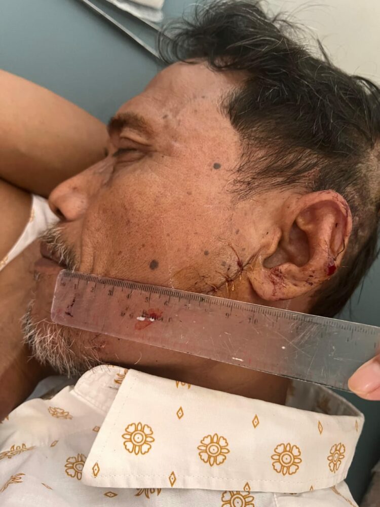 Aca Warga Bukit Lawang Dianiaya Terduga Bandar Narkoba, Justru Dijadikan Tersangka