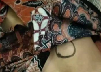 GEGER Warga Simalungun Diduga Ditembak BKO PTPN, Medsos Viral Sebut ‘Percobaan Pemb*nuh4n